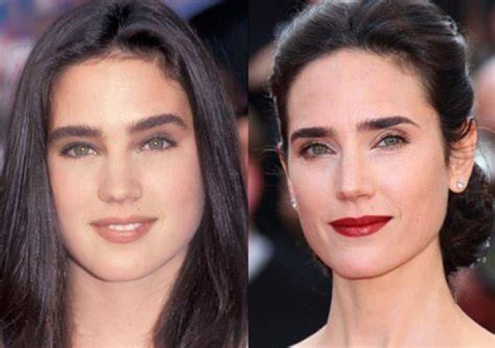 Jennifer Connelly Plastic Surgery Before and After